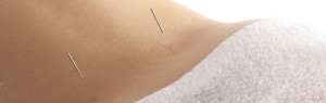 cropped-bigstockphoto_Acupuncture_Of_The_Back_1502408.jpg